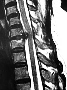 risonanza magnetica